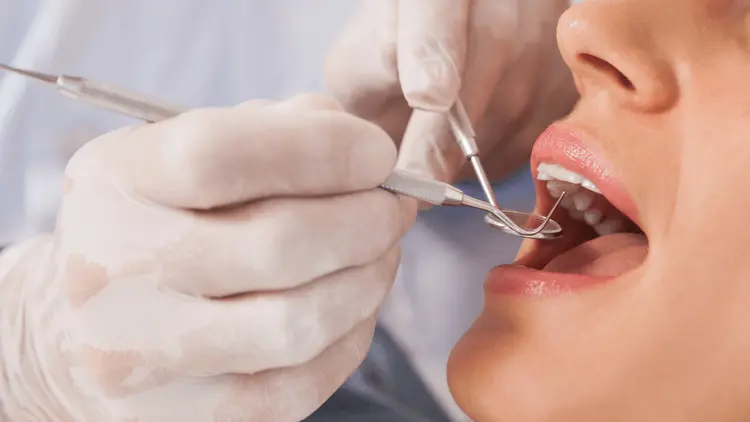 After tooth extractions, cannabidiol emerges as an option for pain