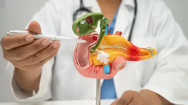 Câncer de pâncreas pode ter sintomas aliviados pelo THC