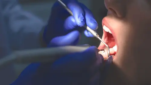 Imagem da noticia: Del dolor al bienestar: la nueva era de la odontología con cannabis