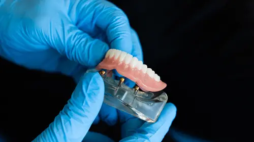 Revestimento de dentaduras com CBD pode prevenir infecções orais, indica estudo