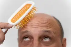 Estudio: El CBD puede ser efectivo contra la alopecia y la caída del cabello