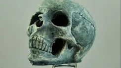 Uso de drogas na pré-história é revelado por dentes